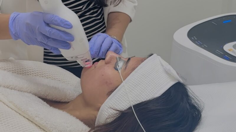 Treating Acne with LASEMD at Modern Aesthetics